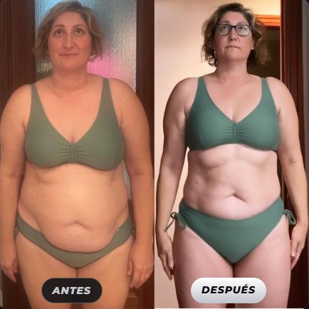Antes y después de una clienta de Renace Fit