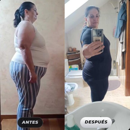 Antes y después de una clienta de Renace Fit