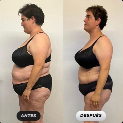 Antes y después de una clienta de Renace Fit